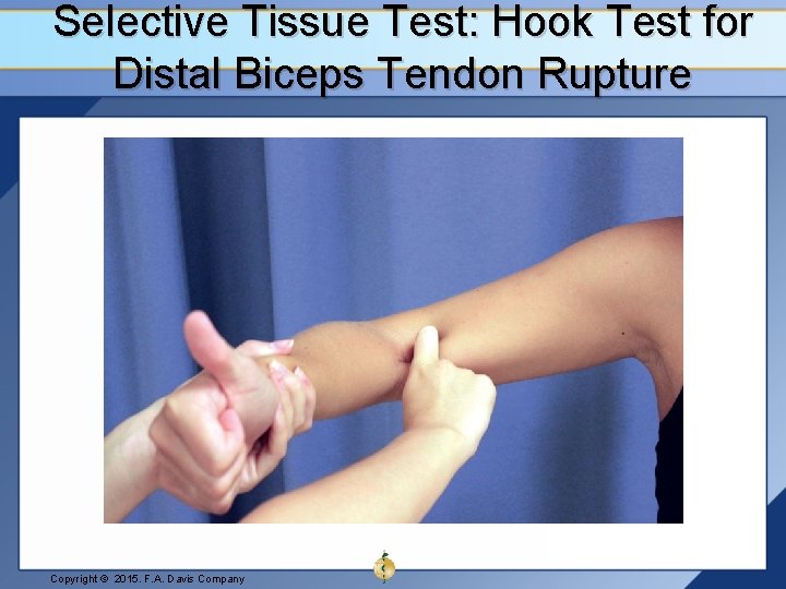 Selective Tissue Test: Hook Test for Distal Biceps Tendon Rupture Copyright © 2015. F.