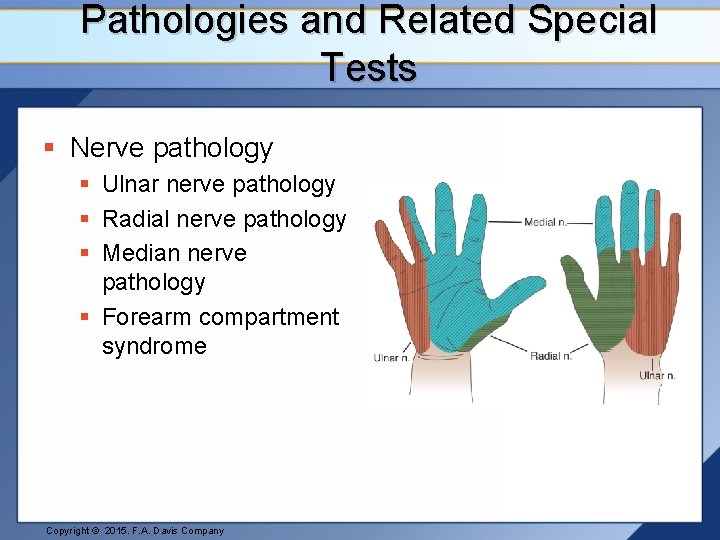 Pathologies and Related Special Tests § Nerve pathology § Ulnar nerve pathology § Radial