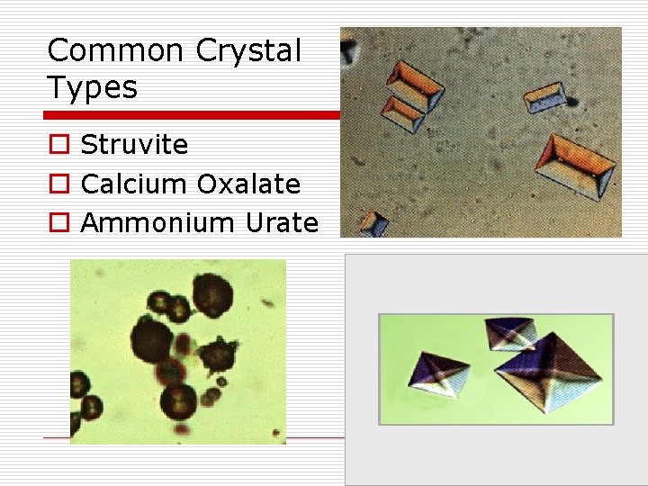 Common Crystal Types o Struvite o Calcium Oxalate o Ammonium Urate 
