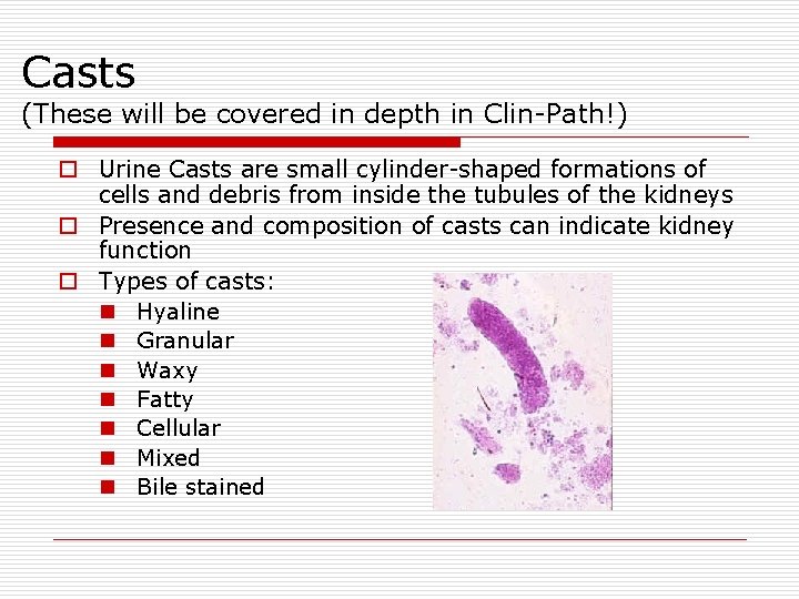 Casts (These will be covered in depth in Clin-Path!) o Urine Casts are small