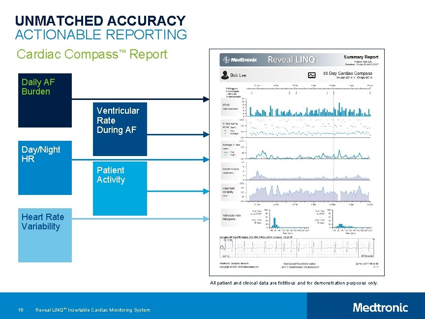 UNMATCHED ACCURACY ACTIONABLE REPORTING Cardiac Compass™ Report Daily AF Burden Ventricular Rate During AF