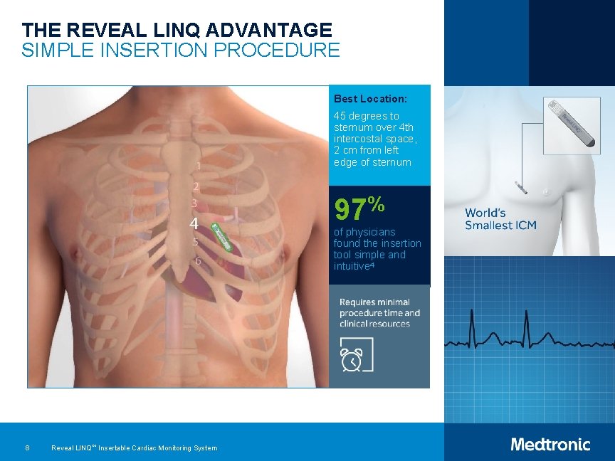 THE REVEAL LINQ ADVANTAGE SIMPLE INSERTION PROCEDURE Best Location: 45 degrees to sternum over