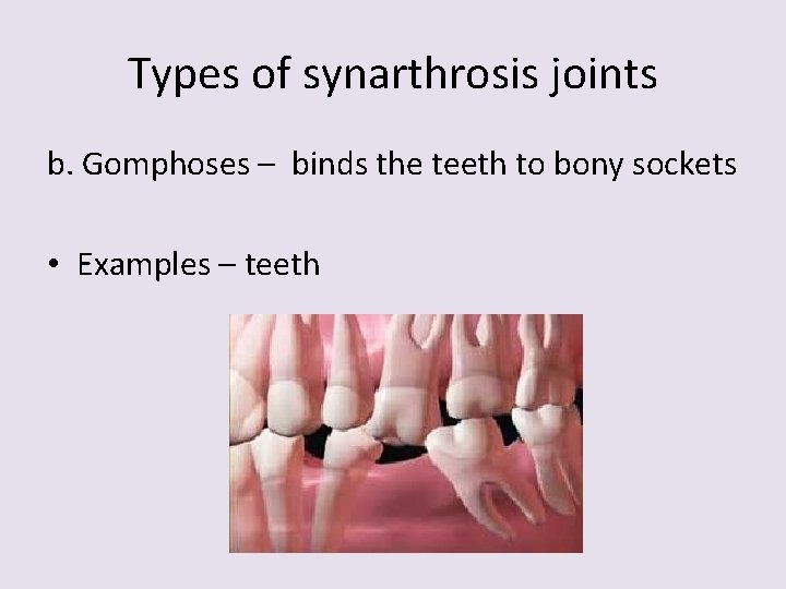 Types of synarthrosis joints b. Gomphoses – binds the teeth to bony sockets •