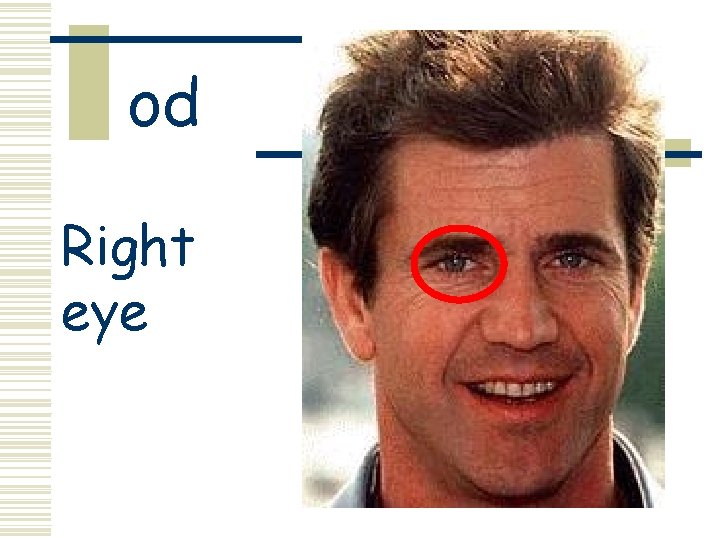 od Right eye 