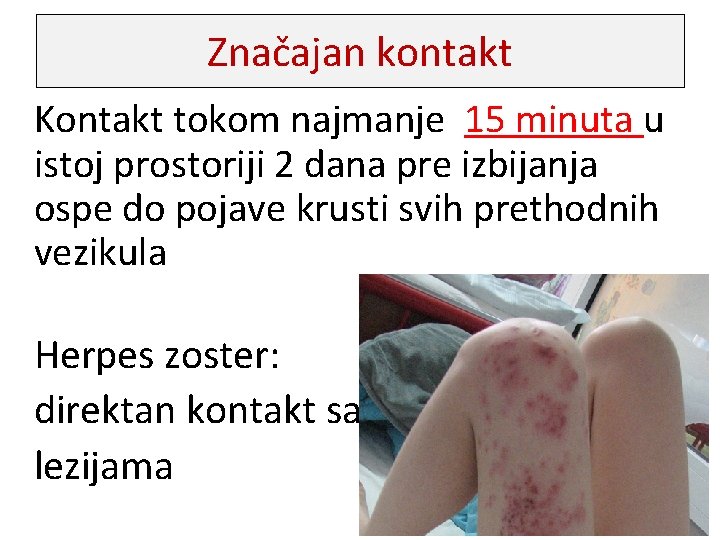 Značajan kontakt Kontakt tokom najmanje 15 minuta u istoj prostoriji 2 dana pre izbijanja