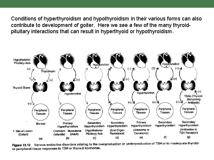 Conditions of hyperthyroidism and hypothyroidism in their various forms can also contribute to development