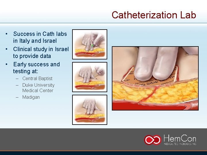 Catheterization Lab • Success in Cath labs in Italy and Israel • Clinical study