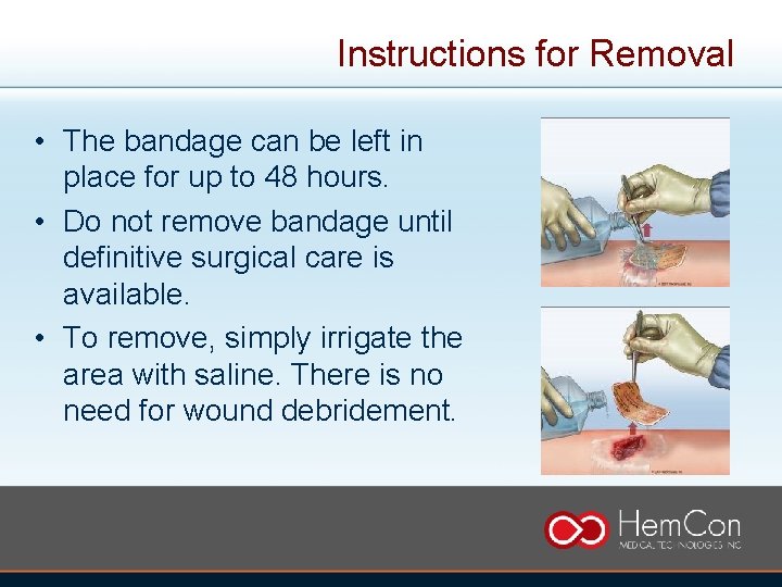 Instructions for Removal • The bandage can be left in place for up to