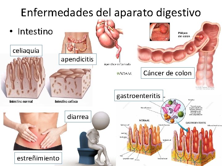 Enfermedades del aparato digestivo • Intestino celiaquía apendicitis Cáncer de colon gastroenteritis diarrea estreñimiento