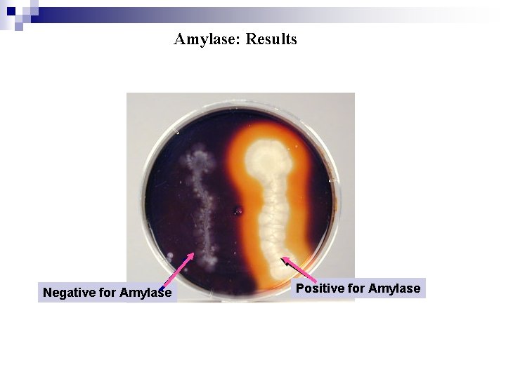 Amylase: Results Negative for Amylase Positive for Amylase 