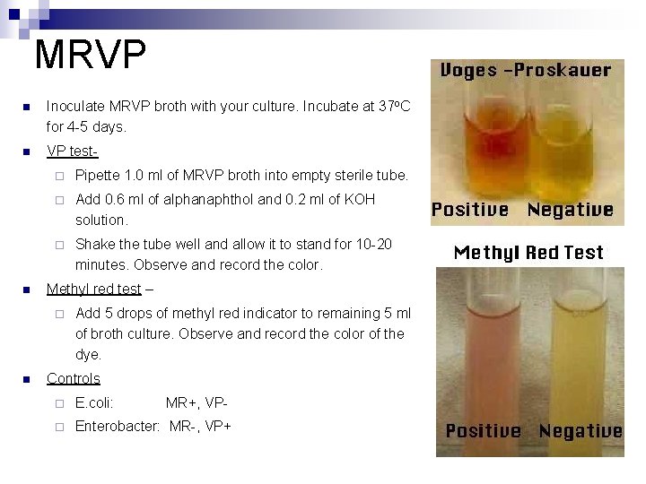 MRVP n Inoculate MRVP broth with your culture. Incubate at 37 o. C for