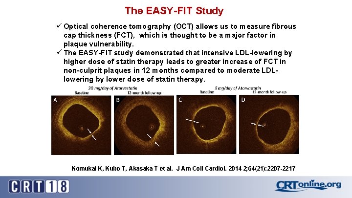 The EASY-FIT Study ü Optical coherence tomography (OCT) allows us to measure fibrous cap