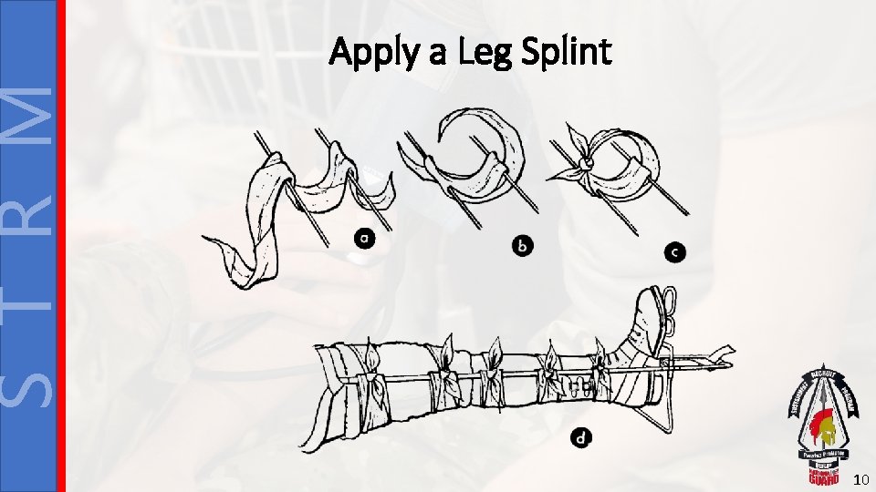S T R M Apply a Leg Splint 10 