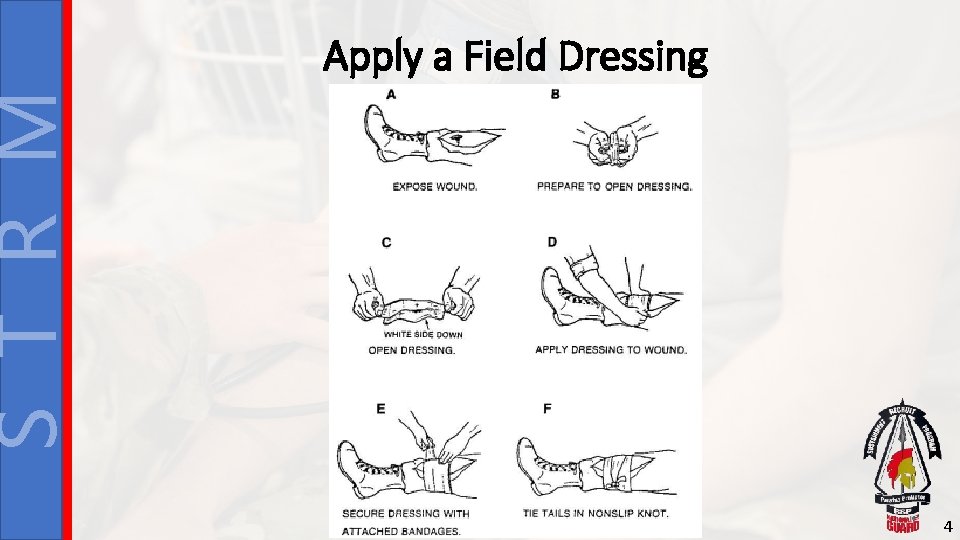 S T R M Apply a Field Dressing 4 