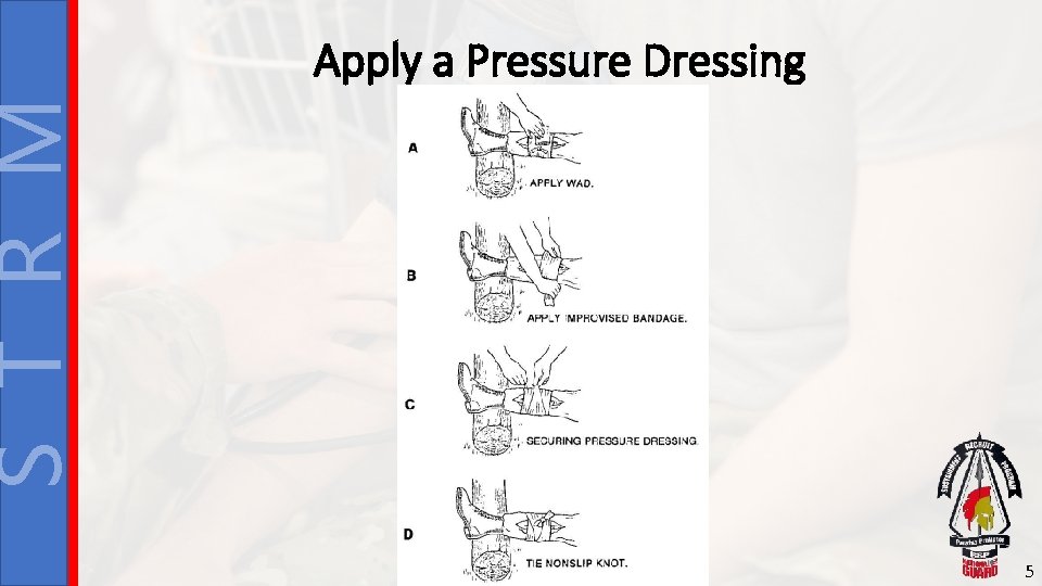 S T R M Apply a Pressure Dressing 5 