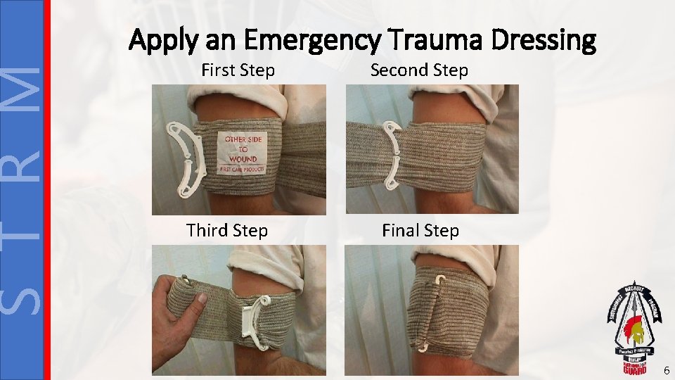 S T R M Apply an Emergency Trauma Dressing First Step Third Step Second
