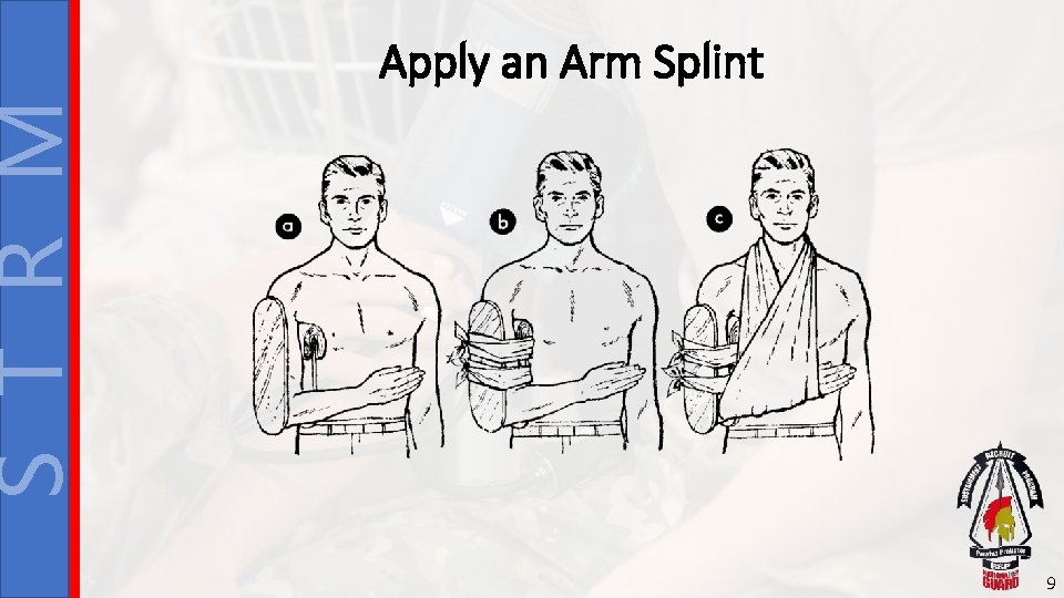 S T R M Apply an Arm Splint 9 