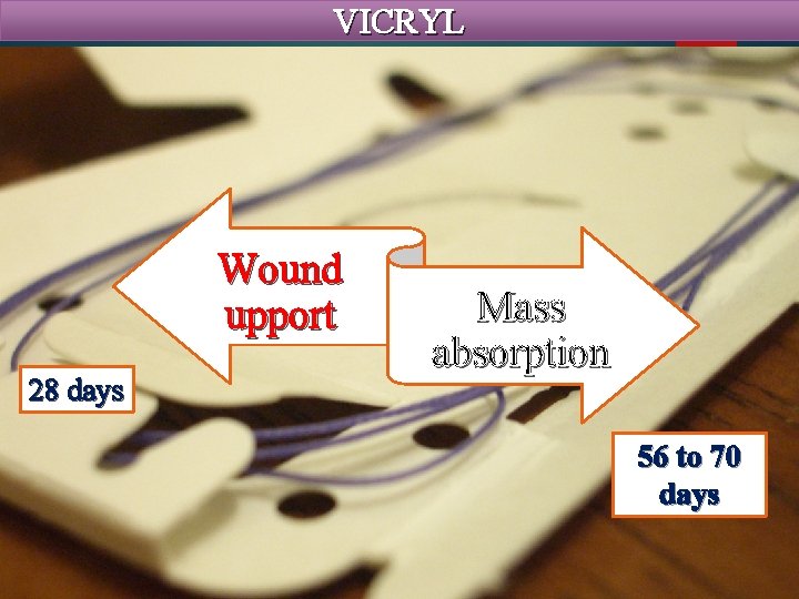 VICRYL Wound upport 28 days Mass absorption 56 to 70 days 