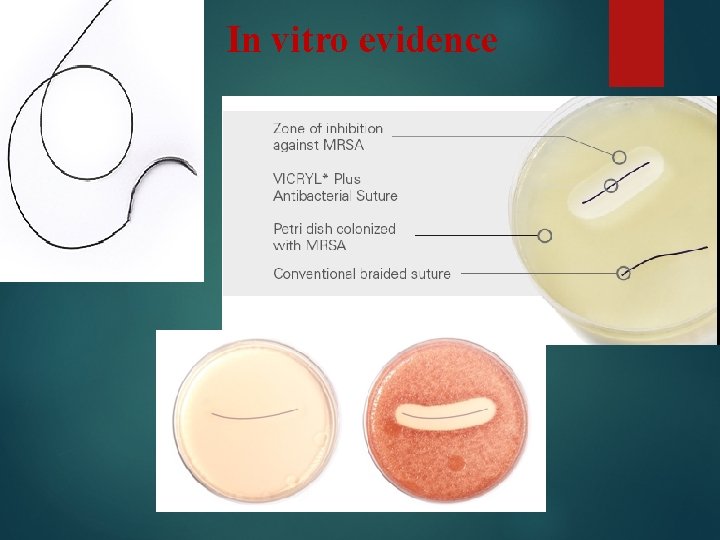 In vitro evidence 