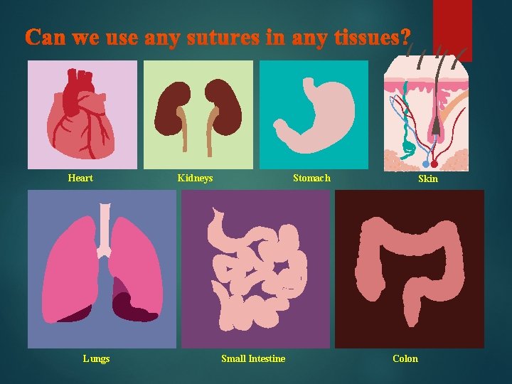 Heart Lungs Kidneys Stomach Small Intestine Skin Colon 