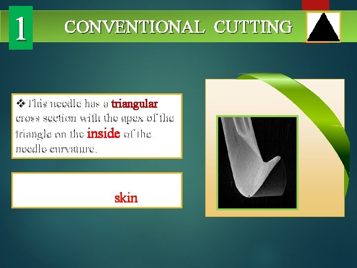 1 CONVENTIONAL CUTTING v. This needle has a triangular cross section with the apex