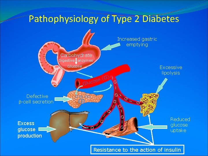 Pathophysiology of Type 2 Diabetes Increased gastric emptying Carbohydrate Digestive enzymes Glucose Excessive lipolysis