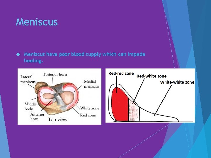 Meniscus have poor blood supply which can impede heeling. 