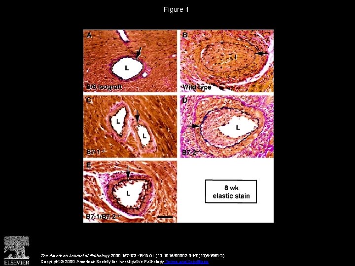 Figure 1 The American Journal of Pathology 2000 157473 -484 DOI: (10. 1016/S 0002