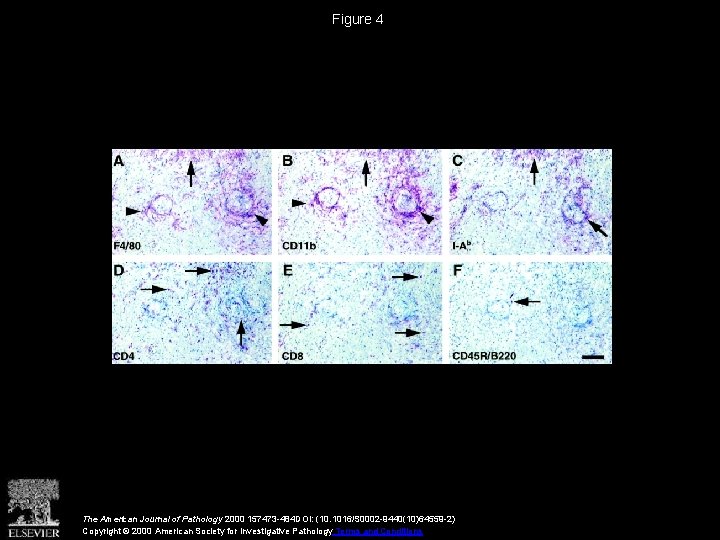 Figure 4 The American Journal of Pathology 2000 157473 -484 DOI: (10. 1016/S 0002