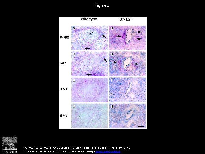 Figure 5 The American Journal of Pathology 2000 157473 -484 DOI: (10. 1016/S 0002