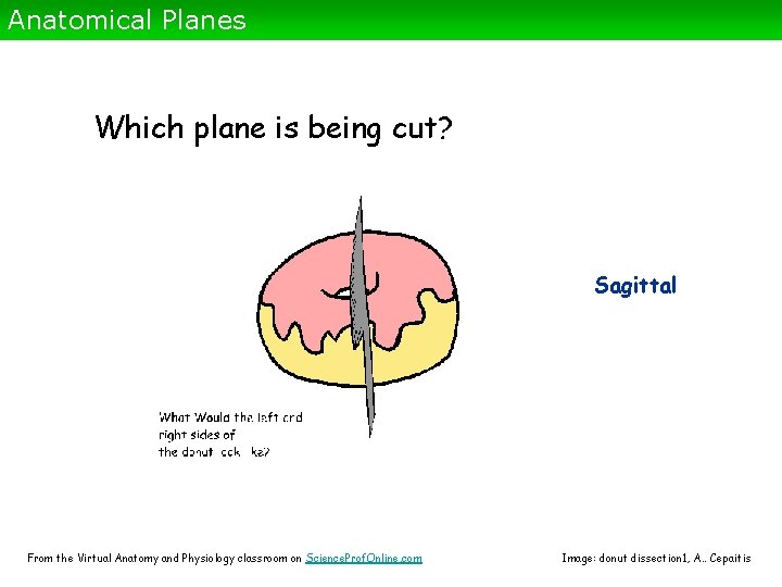Anatomical Planes Which plane is being cut? Sagittal From the Virtual Anatomy and Physiology