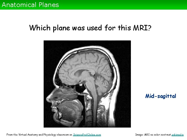 Anatomical Planes Which plane was used for this MRI? Mid-sagittal From the Virtual Anatomy