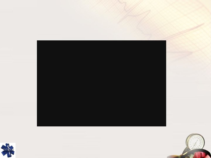 AMY A Better Understanding… 