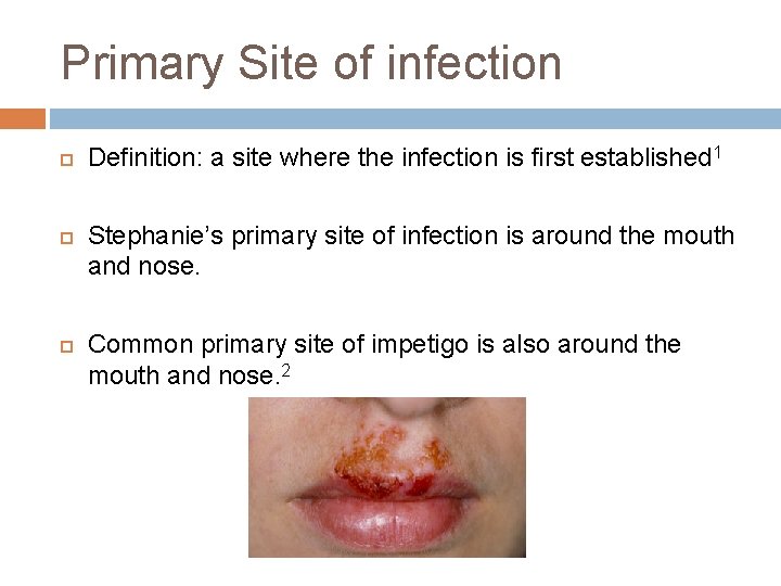 Primary Site of infection Definition: a site where the infection is first established 1