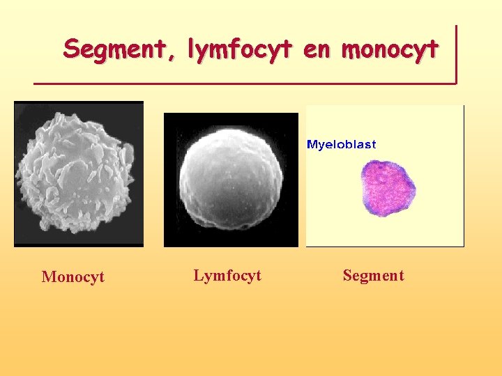 Segment, lymfocyt en monocyt Monocyt Lymfocyt Segment 