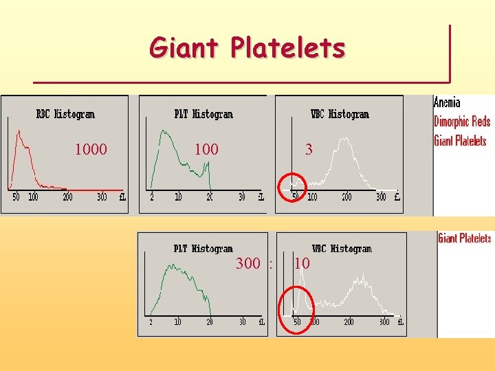 Giant Platelets 1000 100 3 300 : 10 