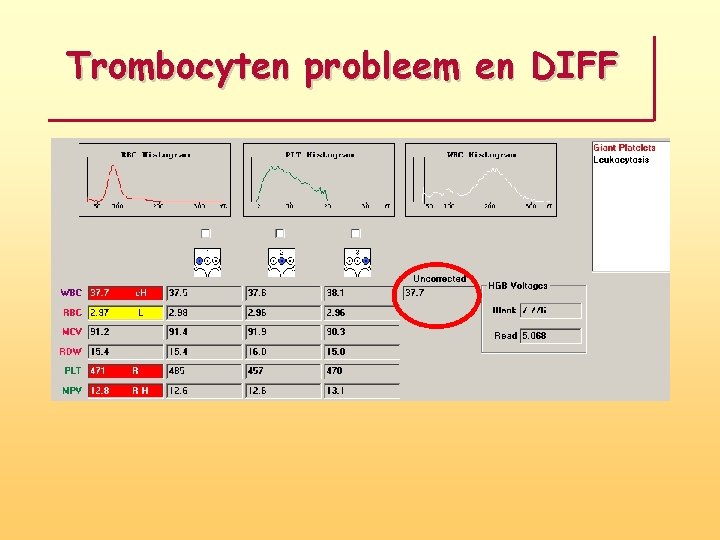 Trombocyten probleem en DIFF 