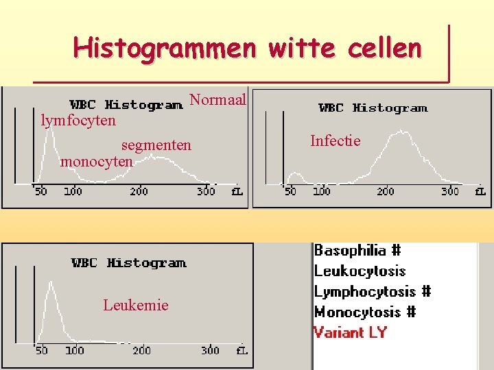 Histogrammen witte cellen Normaal lymfocyten segmenten monocyten Leukemie Infectie 