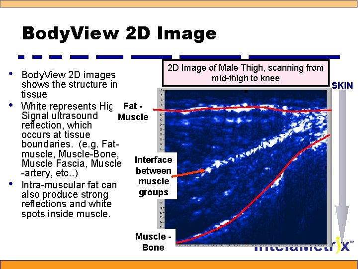 Body. View 2 D Image • • • 2 D Image of Male Thigh,
