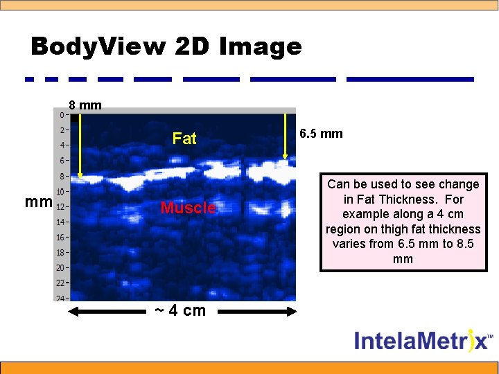 Body. View 2 D Image 8 mm Fat mm Muscle ~ 4 cm 6.