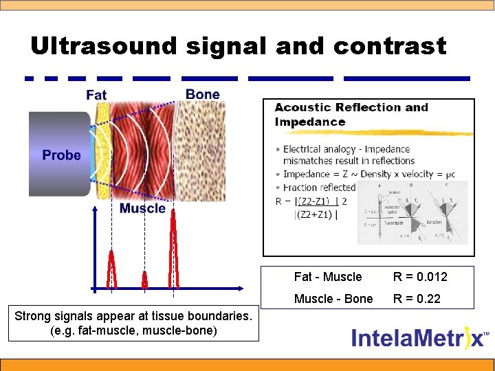 Ultrasound signal and contrast Strong signals appear at tissue boundaries. (e. g. fat-muscle, muscle-bone)