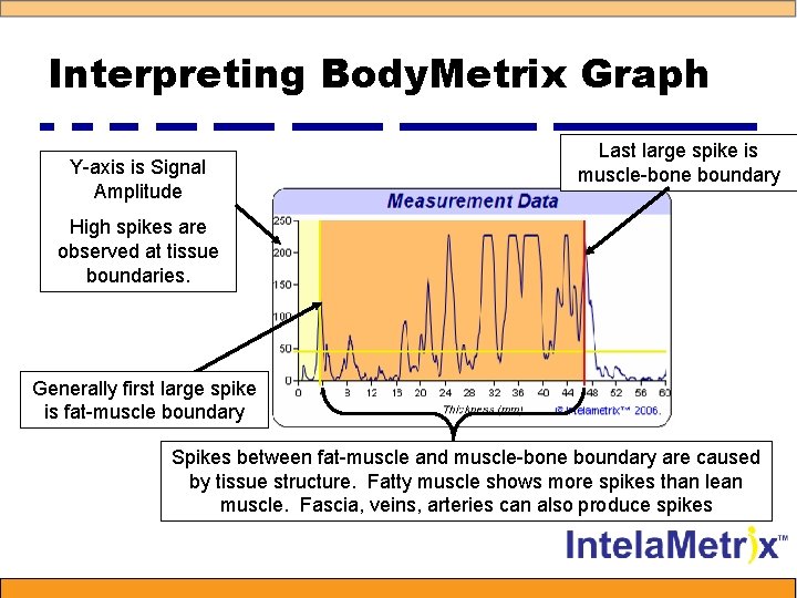 Interpreting Body. Metrix Graph Y-axis is Signal Amplitude Last large spike is muscle-bone boundary