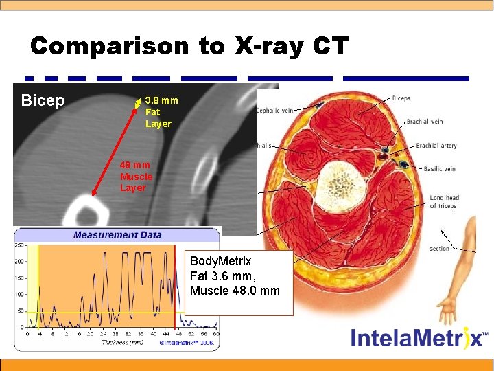 Comparison to X-ray CT Bicep 3. 8 mm Fat Layer 49 mm Muscle Layer