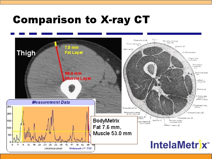 Comparison to X-ray CT Thigh 7. 8 mm Fat Layer 58. 0 mm Muscle