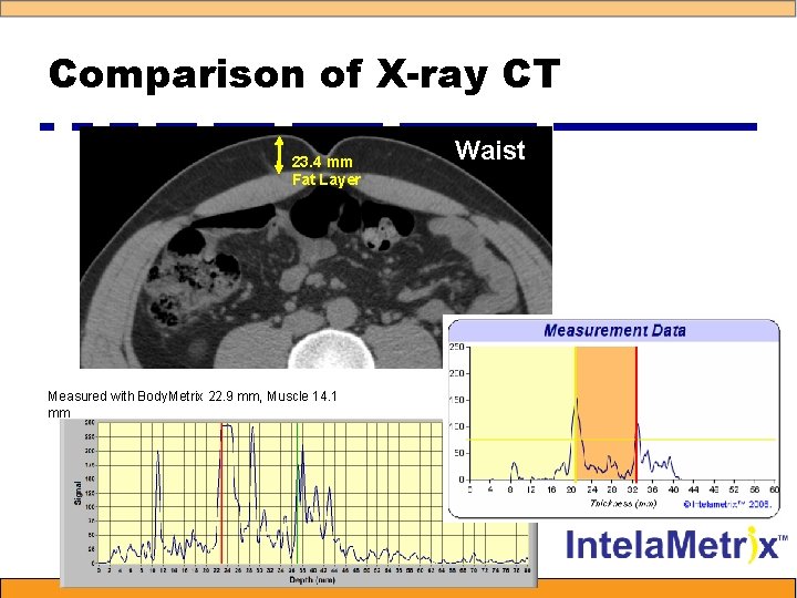 Comparison of X-ray CT 23. 4 mm Fat Layer Measured with Body. Metrix 22.
