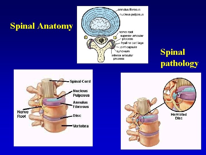 Spinal Anatomy Spinal pathology 