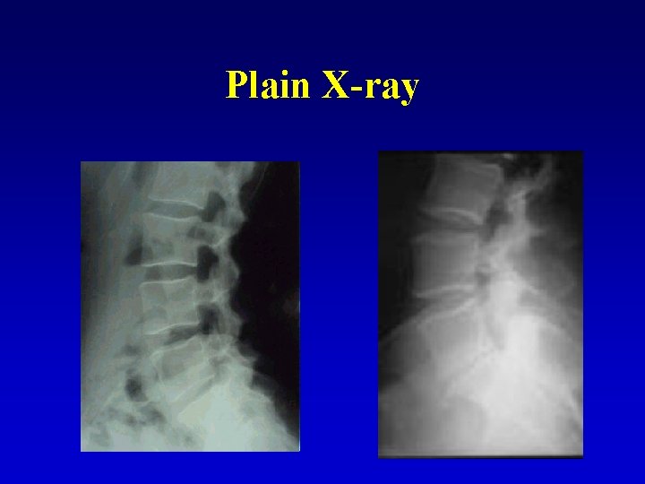 Plain X-ray 