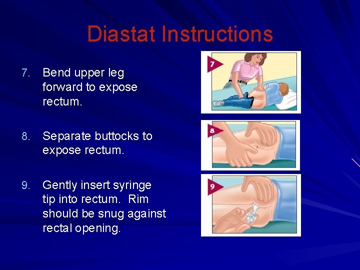 Diastat Instructions 7. Bend upper leg forward to expose rectum. 8. Separate buttocks to