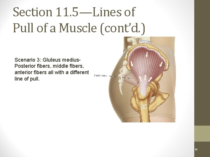 Section 11. 5—Lines of Pull of a Muscle (cont’d. ) Scenario 3: Gluteus medius.