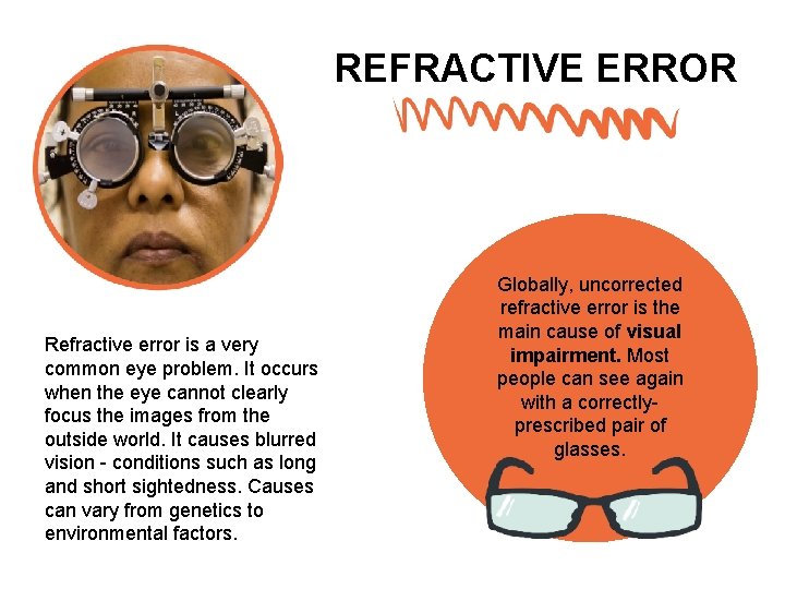 REFRACTIVE ERROR Refractive error is a very common eye problem. It occurs when the